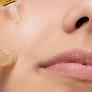 BB Glow Facial Treatment