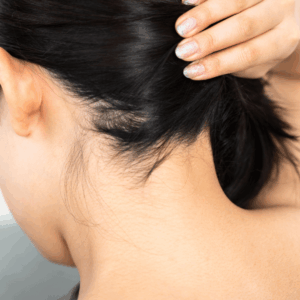 Carbon+Picolaser Treatment -Neck & Nape Whitening