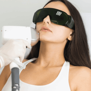Diode - Facial Hair Removal
