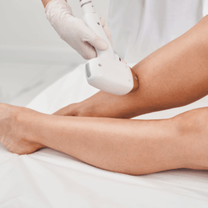 Diode - Half Leg Hair Removal