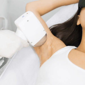 Diode - Underarm Hair Removal
