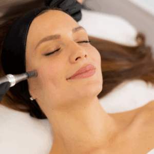 Facial Microneedling